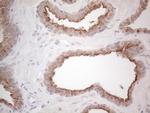 ABCC5 Antibody in Immunohistochemistry (Paraffin) (IHC (P))