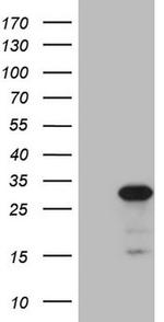 ABCC5 Antibody in Western Blot (WB)