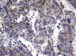 ABCD1 Antibody in Immunohistochemistry (Paraffin) (IHC (P))