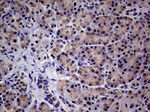 ABCD1 Antibody in Immunohistochemistry (Paraffin) (IHC (P))