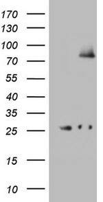 ABCD1 Antibody in Western Blot (WB)