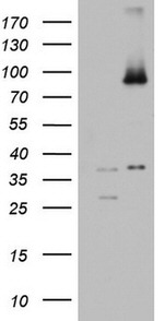 ABCD1 Antibody in Western Blot (WB)