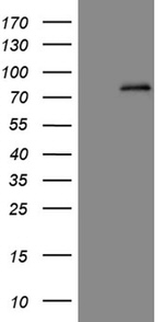 ABCD1 Antibody in Western Blot (WB)