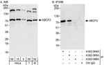 ABCF2 Antibody in Western Blot (WB)