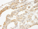 ABCF2 Antibody in Immunohistochemistry (IHC)