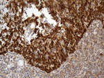 ABCF2 Antibody in Immunohistochemistry (Paraffin) (IHC (P))