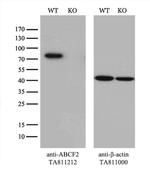 ABCF2 Antibody