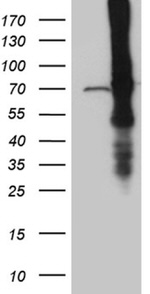 ABCF2 Antibody in Western Blot (WB)