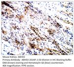 ABHD2 Antibody in Immunohistochemistry (IHC)