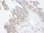 ABI1 Antibody in Immunohistochemistry (IHC)