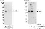 ABI2 Antibody in Western Blot (WB)