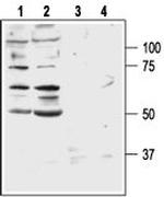 Bombesin Receptor 2 (GRPR) (extracellular) Antibody in Western Blot (WB)