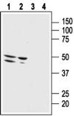 Bombesin Receptor 3 (extracellular) Antibody in Western Blot (WB)
