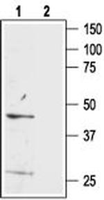 Bombesin Receptor 3 (extracellular) Antibody in Western Blot (WB)