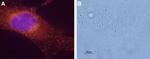 Bombesin Receptor 1 (NMBR) Antibody in Immunocytochemistry (ICC/IF)