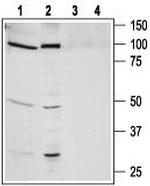 Bombesin Receptor 1 (NMBR) Antibody in Western Blot (WB)