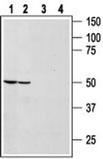 Bombesin Receptor 1 (NMBR) Antibody in Western Blot (WB)