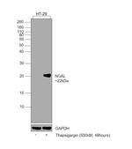 NGAL Antibody