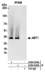 ABT1 Antibody in Western Blot (WB)