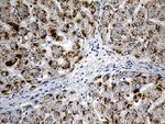 ACAA1 Antibody in Immunohistochemistry (Paraffin) (IHC (P))