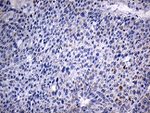 ACAA1 Antibody in Immunohistochemistry (Paraffin) (IHC (P))