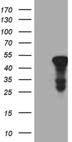 ACAA1 Antibody in Western Blot (WB)