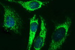 ACAA2 Antibody in Immunocytochemistry (ICC/IF)