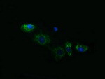 ACAA2 Antibody in Immunocytochemistry (ICC/IF)