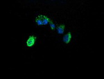 ACAA2 Antibody in Immunocytochemistry (ICC/IF)