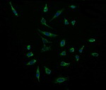 ACAA2 Antibody in Immunocytochemistry (ICC/IF)