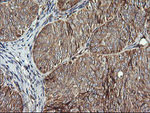 ACAA2 Antibody in Immunohistochemistry (Paraffin) (IHC (P))