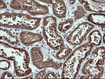 ACAA2 Antibody in Immunohistochemistry (Paraffin) (IHC (P))