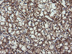 ACAA2 Antibody in Immunohistochemistry (Paraffin) (IHC (P))