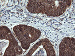 ACAA2 Antibody in Immunohistochemistry (Paraffin) (IHC (P))