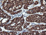 ACAA2 Antibody in Immunohistochemistry (Paraffin) (IHC (P))