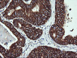 ACAA2 Antibody in Immunohistochemistry (Paraffin) (IHC (P))