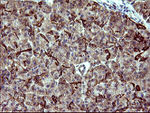 ACAA2 Antibody in Immunohistochemistry (Paraffin) (IHC (P))