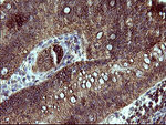 ACAA2 Antibody in Immunohistochemistry (Paraffin) (IHC (P))