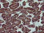 ACAA2 Antibody in Immunohistochemistry (Paraffin) (IHC (P))