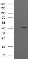 ACAA2 Antibody in Western Blot (WB)