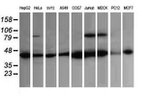 ACAA2 Antibody in Western Blot (WB)