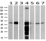 ACAA2 Antibody in Western Blot (WB)