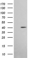 ACAA2 Antibody in Western Blot (WB)