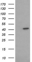 ACAA2 Antibody in Western Blot (WB)