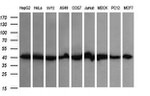 ACAA2 Antibody in Western Blot (WB)