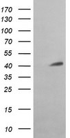 ACAA2 Antibody in Western Blot (WB)