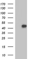 ACAA2 Antibody in Western Blot (WB)