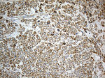 ACAD9 Antibody in Immunohistochemistry (Paraffin) (IHC (P))