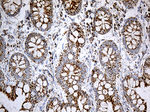 ACADM Antibody in Immunohistochemistry (Paraffin) (IHC (P))