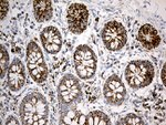 ACADM Antibody in Immunohistochemistry (Paraffin) (IHC (P))